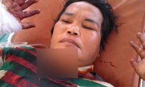 Tak Terima Anak Disenggol, Ucok Bacok Leher Upik