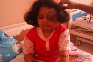 Bocah Tumor Mata dari Aceh Dirujuk ke Jakarta